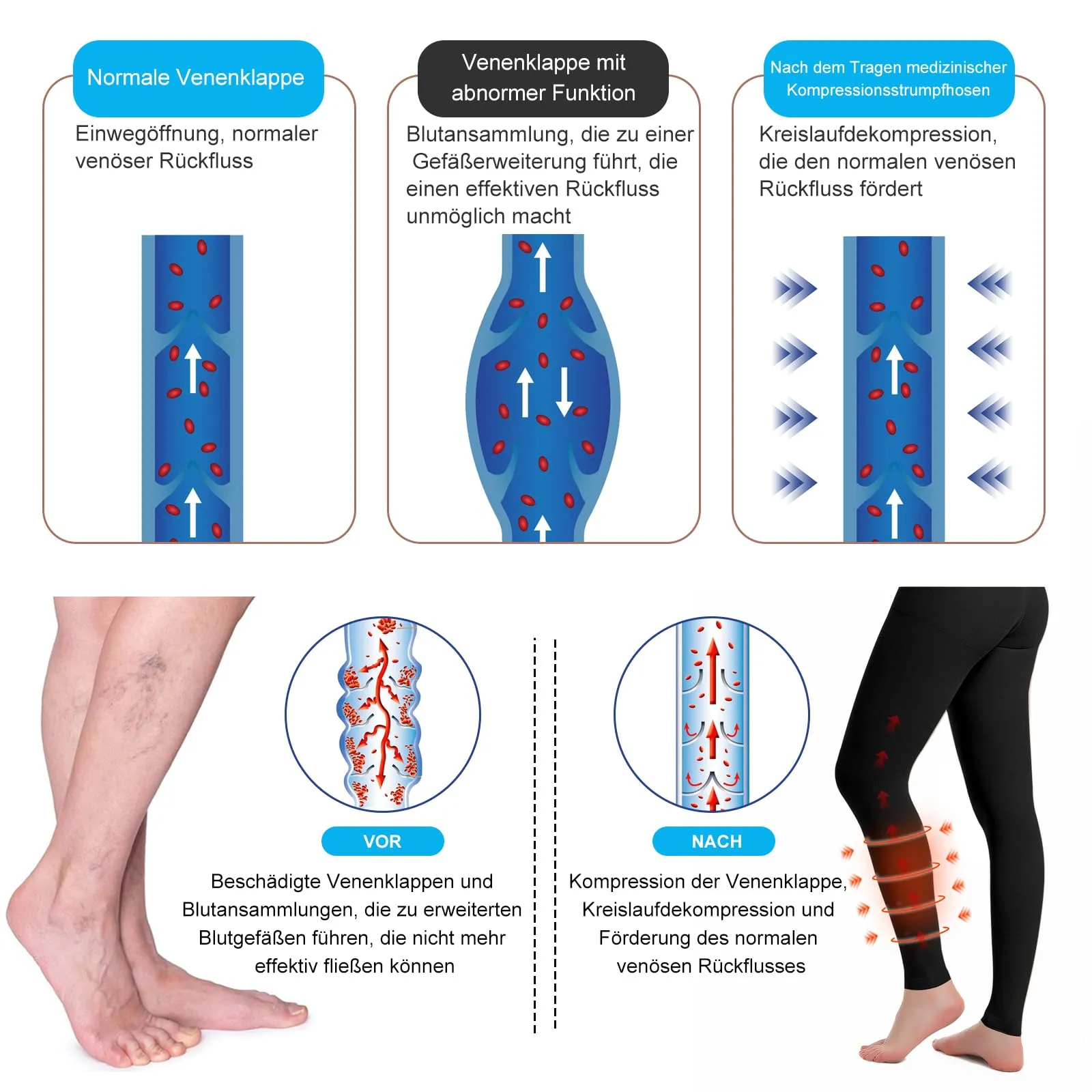 2 pairs of medical compression stockings for women and men 20-30 mmHg, progressive support tights, opaque toe-free compression trousers class 2, suitable for varicose vein edema, TVT XXL