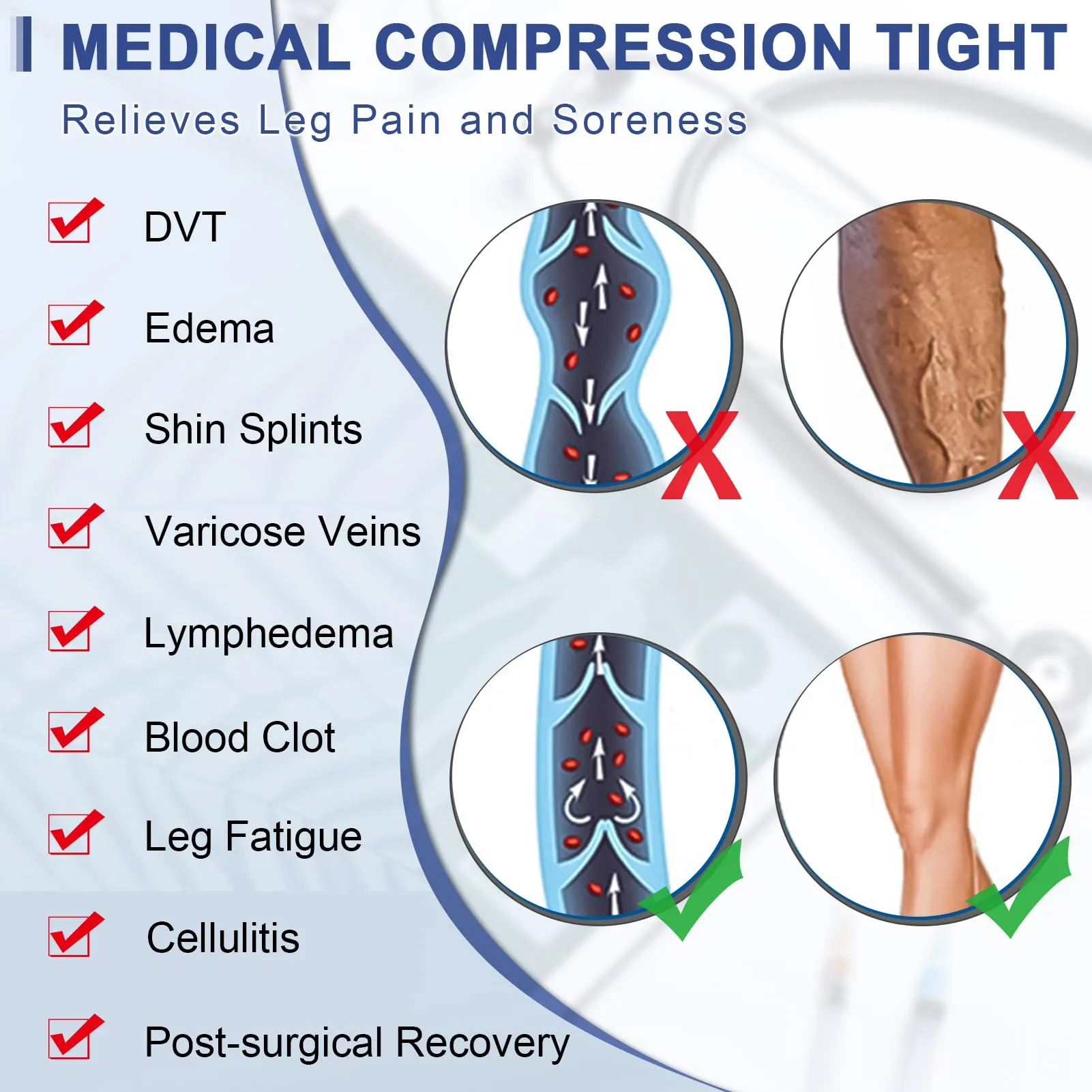 beister Medical compression stockings for women, long, 20-30 mmHg, support stockings for men, opaque toe-free compression trousers, class 2, solid support for varicose veins, edema, black M