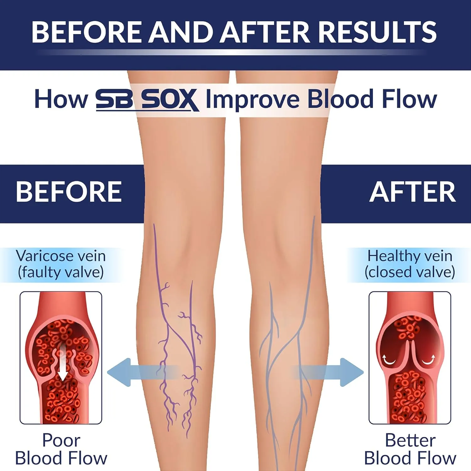 SB SOX 3-Pair Compression Socks for Women & Men (15-20mmHg) – Womens Compression Socks All Day Wear!